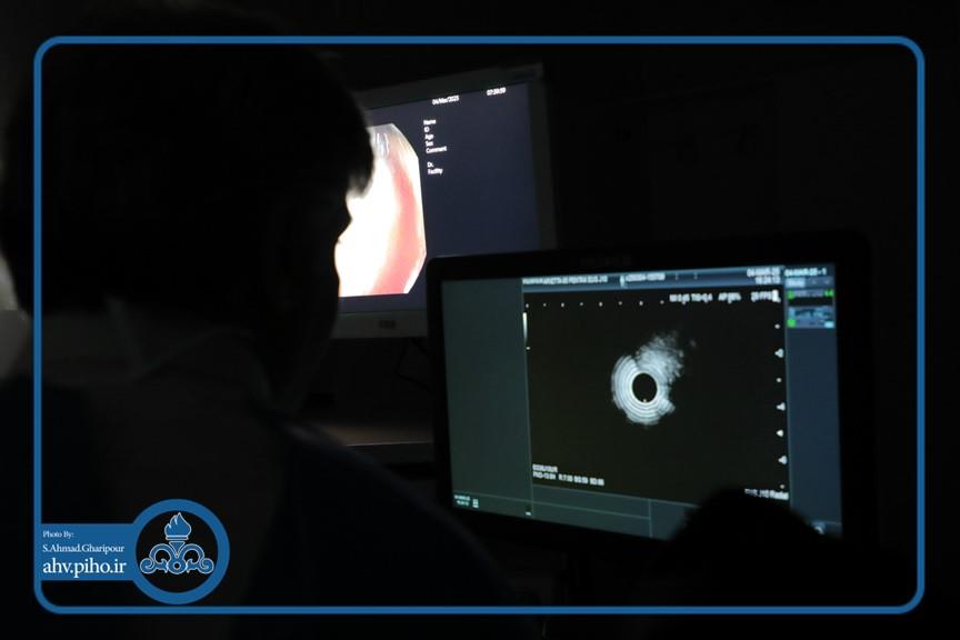 اندوسونوگرافی